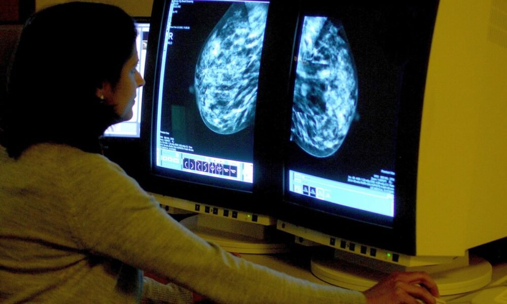 Tens of thousands of lives at risk because cancer patients live too far from hospitals, Macmillan warns