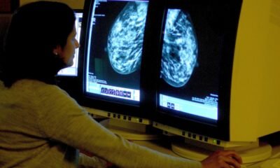 Tens of thousands of lives at risk because cancer patients live too far from hospitals, Macmillan warns