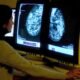 Tens of thousands of lives at risk because cancer patients live too far from hospitals, Macmillan warns
