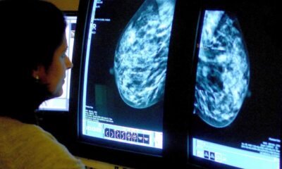 How routine breast screenings could help predict heart problems