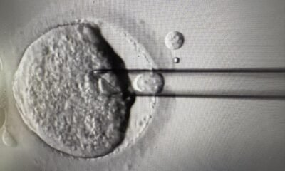 New tests on IVF embryos ‘could help women over 35 conceive faster’