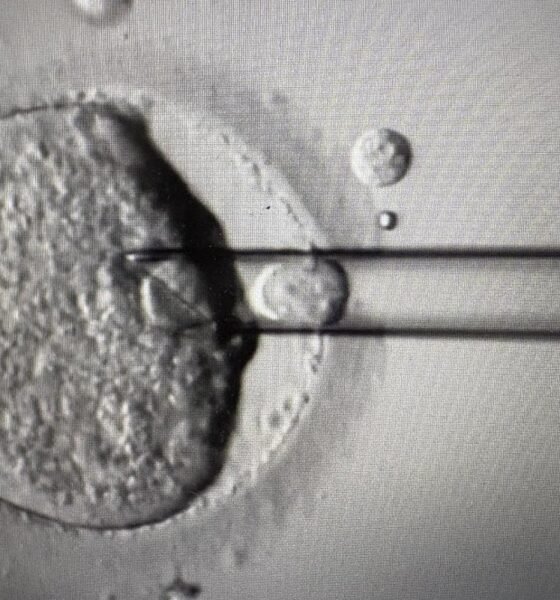 New tests on IVF embryos ‘could help women over 35 conceive faster’