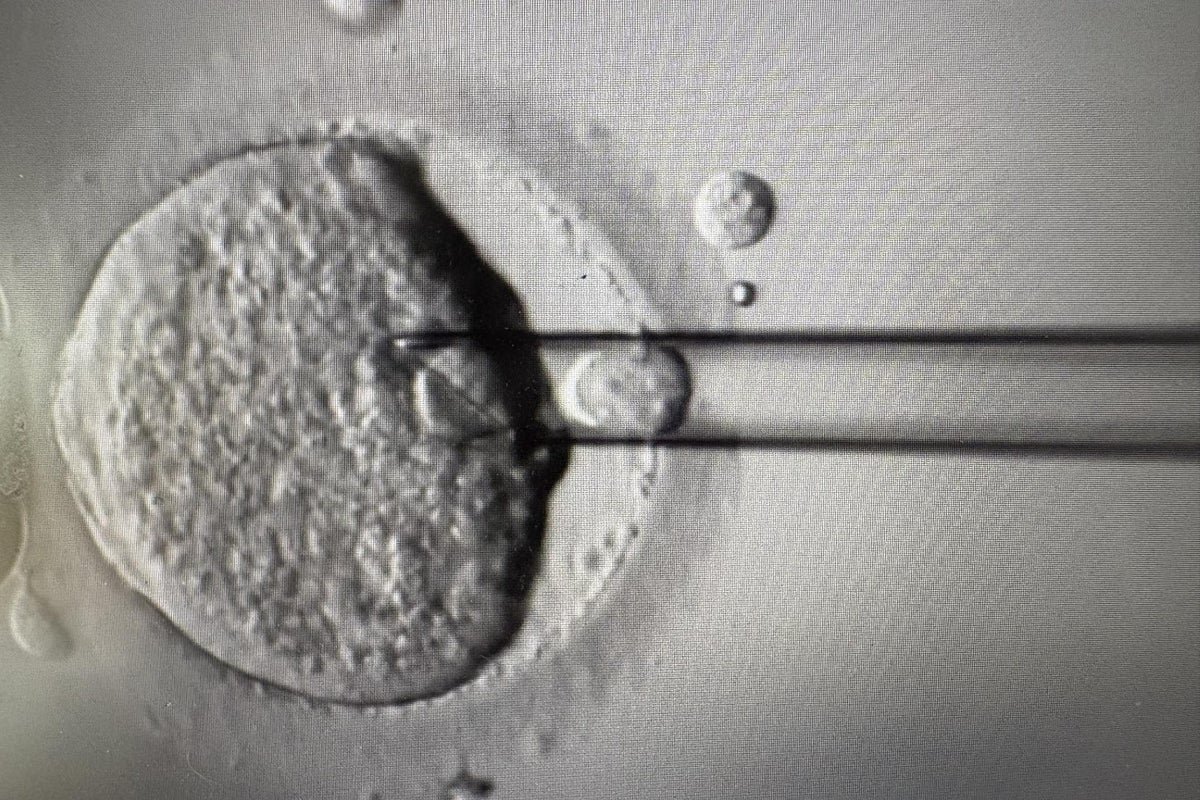 New tests on IVF embryos ‘could help women over 35 conceive faster’