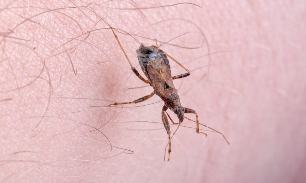 Mapped: Where the deadly kissing bug Chagas has spread to in the US