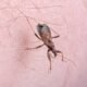 The symptoms of ‘kissing bug’ disease to be on the look out for