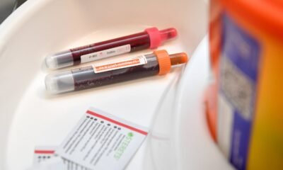 Patients with aggressive cancer ‘slipping through the cracks’ in NHS