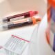 Patients with aggressive cancer ‘slipping through the cracks’ in NHS
