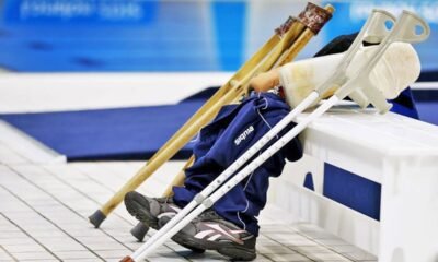 The new technology for prosthetic legs that could reduce NHS waiting lists by 50%