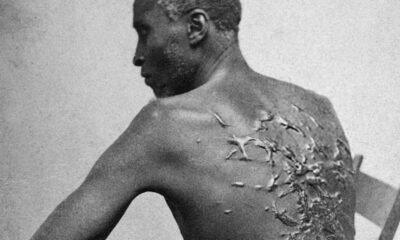 National park to remove exhibit of famed photograph showing former slave’s scarred back, says report
