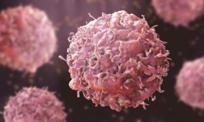 Shocking Discovery: New Research Reveals How Glucose Supercharges Your Immune Cells to Battle Cancer!