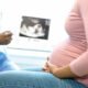 Shocking Reality: How Nigeria's Doctor Shortage Fuels Preventable Maternal Deaths – Uncover the Untold Stories!
