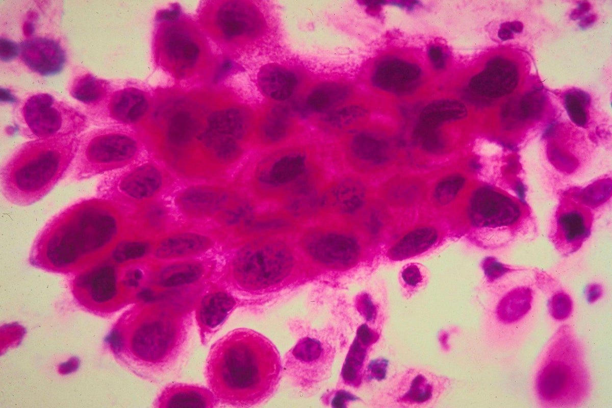 Warning after cancer patients died following delays in getting life-saving emergency drugs