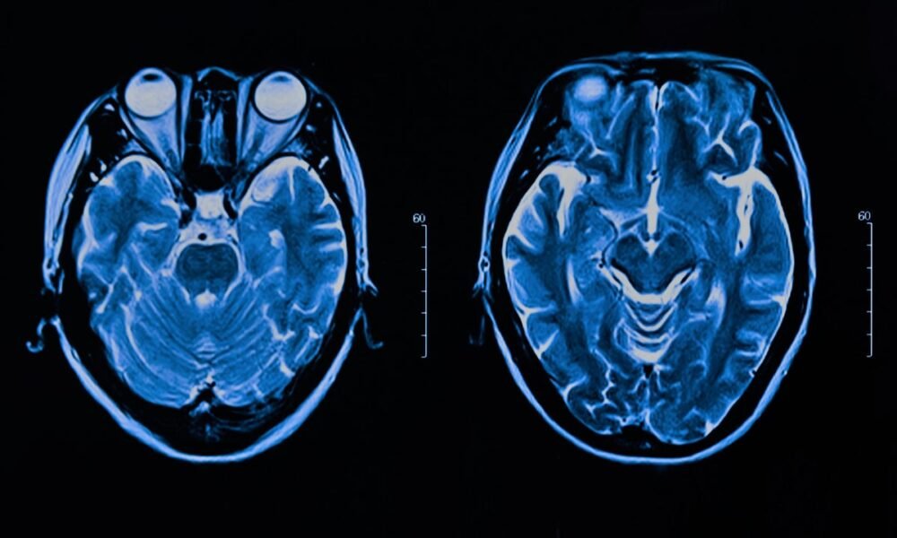 How AI could detect signs of mental illness