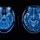 How AI could detect signs of mental illness