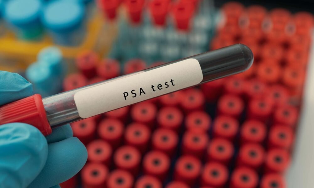 These men are at high risk for prostate cancer – so why are they set to miss out on a screening programme?
