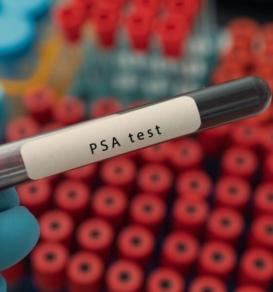 These men are at high risk for prostate cancer – so why are they set to miss out on a screening programme?