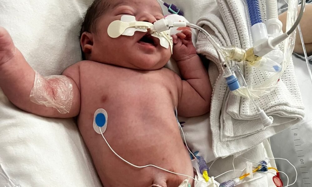 ‘My baby was left with brain damage after he was deprived of oxygen’