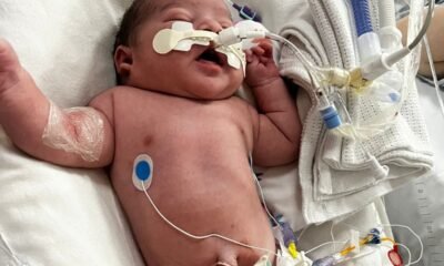 ‘My baby was left with brain damage after he was deprived of oxygen’
