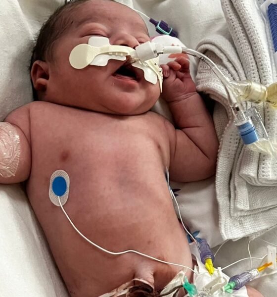 ‘My baby was left with brain damage after he was deprived of oxygen’