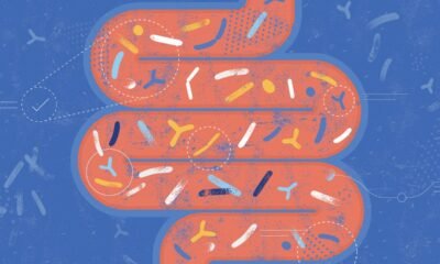 Microplastics can affect the gut in ways that mirror the impact of cancer, research suggests