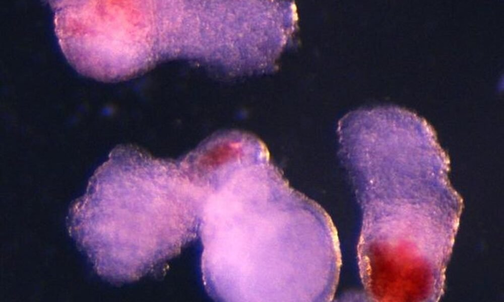 Scientists create lab-grown human embryo model with blood cells