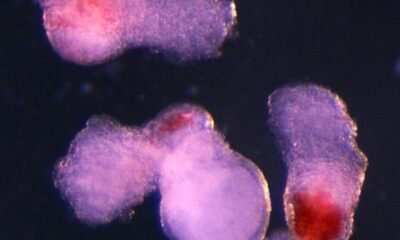Scientists create lab-grown human embryo model with blood cells